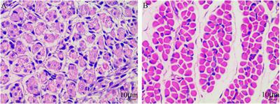 Characterization of lncRNA/circRNA-miRNA-mRNA network to reveal potential functional ceRNAs in the skeletal muscle of chicken
